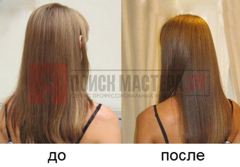 Почему выпадают волосы при сахарном диабете